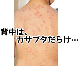 背中のかさぶた