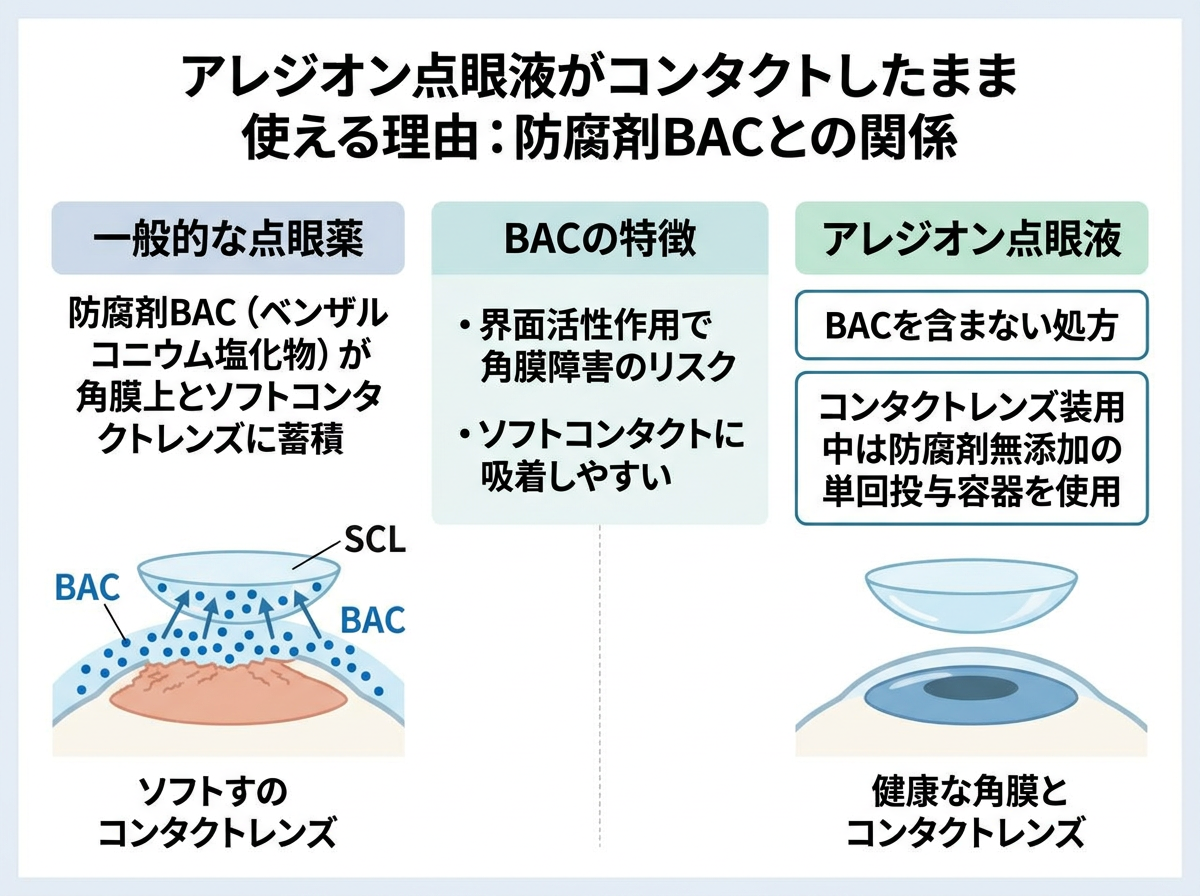 アレジオン点眼液がコンタクトしたまま使える理由：防腐剤BACとの関係