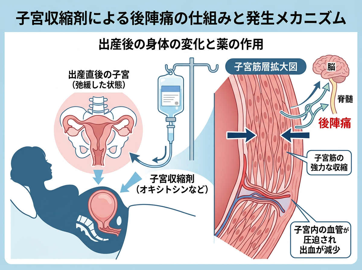 子宮収縮剤による後陣痛の仕組みと発生メカニズム